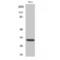 Distal-Less Homeobox 5 antibody, LS-C383155, Lifespan Biosciences, Western Blot image 