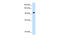 SEC63 Homolog, Protein Translocation Regulator antibody, ARP46839_T100, Aviva Systems Biology, Western Blot image 