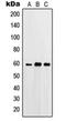 Protein Kinase C Substrate 80K-H antibody, orb214447, Biorbyt, Western Blot image 