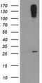 C-type lectin domain family 4 member E antibody, M06084-1, Boster Biological Technology, Western Blot image 