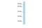 Ankyrin Repeat Domain 9 antibody, PA5-69883, Invitrogen Antibodies, Western Blot image 