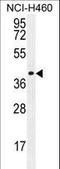 Coiled-Coil Domain Containing 54 antibody, LS-C168426, Lifespan Biosciences, Western Blot image 