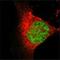 Lysine Acetyltransferase 8 antibody, NBP1-28879, Novus Biologicals, Immunofluorescence image 