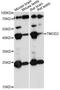 Tropomodulin 2 antibody, LS-C749861, Lifespan Biosciences, Western Blot image 