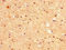 Vasohibin 1 antibody, LS-C371553, Lifespan Biosciences, Immunohistochemistry paraffin image 