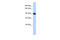 Matrilin 2 antibody, 27-108, ProSci, Western Blot image 