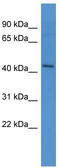 Apelin Receptor antibody, TA342806, Origene, Western Blot image 