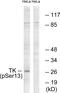 Thymidine Kinase 1 antibody, PA5-38340, Invitrogen Antibodies, Western Blot image 