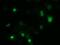 Zinc Finger Imprinted 2 antibody, GTX83402, GeneTex, Immunocytochemistry image 