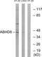 Abhydrolase Domain Containing 8 antibody, GTX87475, GeneTex, Western Blot image 