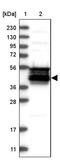 WD Repeat Domain 31 antibody, PA5-53975, Invitrogen Antibodies, Western Blot image 