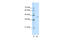 KIAA1572 antibody, 28-400, ProSci, Western Blot image 