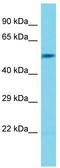 BPI Fold Containing Family B Member 6 antibody, TA331589, Origene, Western Blot image 