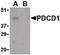 Programmed Cell Death 1 antibody, LS-B1387, Lifespan Biosciences, Western Blot image 