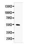 Matrix metalloproteinase-13 antibody, A00420, Boster Biological Technology, Western Blot image 