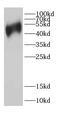 Cyclase Associated Actin Cytoskeleton Regulatory Protein 1 antibody, FNab01246, FineTest, Western Blot image 