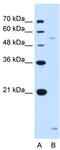 ST3 Beta-Galactoside Alpha-2,3-Sialyltransferase 5 antibody, TA339387, Origene, Western Blot image 
