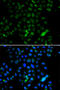 E74 Like ETS Transcription Factor 4 antibody, STJ29260, St John