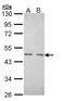Nuclear Receptor Subfamily 2 Group C Member 1 antibody, LS-C109418, Lifespan Biosciences, Western Blot image 
