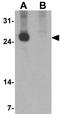 CD160 Molecule antibody, GTX17209, GeneTex, Western Blot image 
