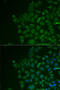 Lecithin retinol acyltransferase antibody, LS-C748315, Lifespan Biosciences, Immunofluorescence image 