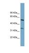 Threonine Synthase Like 2 antibody, NBP1-70723, Novus Biologicals, Western Blot image 