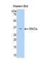 Heparanase antibody, LS-C294465, Lifespan Biosciences, Western Blot image 