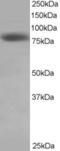 NDC80 Kinetochore Complex Component antibody, 45-725, ProSci, Enzyme Linked Immunosorbent Assay image 