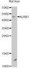 Killer Cell Lectin Like Receptor B1 antibody, A6928, ABclonal Technology, Western Blot image 