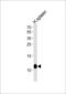 Fc Fragment Of IgE Receptor Ig antibody, 60-772, ProSci, Western Blot image 