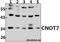 CCR4-NOT Transcription Complex Subunit 7 antibody, A04884, Boster Biological Technology, Western Blot image 