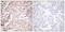 Checkpoint Kinase 2 antibody, LS-C117596, Lifespan Biosciences, Immunohistochemistry frozen image 