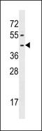 Formyl Peptide Receptor 1 antibody, LS-C159680, Lifespan Biosciences, Western Blot image 