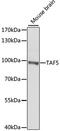 TATA-Box Binding Protein Associated Factor 5 antibody, A7221, ABclonal Technology, Western Blot image 