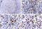 MALT1 Paracaspase antibody, NB100-56158, Novus Biologicals, Immunohistochemistry paraffin image 