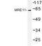 MRE11 Homolog, Double Strand Break Repair Nuclease antibody, LS-C176884, Lifespan Biosciences, Western Blot image 