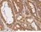 Tubulin Alpha 1a antibody, 101235-T10, Sino Biological, Immunohistochemistry paraffin image 