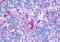 Probable G-protein coupled receptor 132 antibody, MBS246965, MyBioSource, Immunohistochemistry paraffin image 