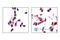 Acetyl-CoA Carboxylase Alpha antibody, 3661S, Cell Signaling Technology, Immunohistochemistry paraffin image 