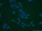 Alpha-1,6-Mannosylglycoprotein 6-Beta-N-Acetylglucosaminyltransferase B antibody, 16993-1-AP, Proteintech Group, Immunofluorescence image 