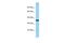 Trace Amine Associated Receptor 9 (Gene/Pseudogene) antibody, A16607, Boster Biological Technology, Western Blot image 