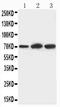Kelch Like ECH Associated Protein 1 antibody, PA1658, Boster Biological Technology, Western Blot image 