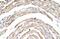 Cleavage And Polyadenylation Specific Factor 6 antibody, GTX47333, GeneTex, Immunohistochemistry paraffin image 