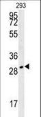 Tryptase Alpha/Beta 1 antibody, LS-C160149, Lifespan Biosciences, Western Blot image 