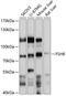 Follicle Stimulating Hormone Receptor antibody, 15-735, ProSci, Western Blot image 