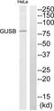 GUSB antibody, abx014267, Abbexa, Western Blot image 