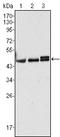 Keratin 17 antibody, STJ97983, St John