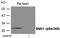 Snail Family Transcriptional Repressor 1 antibody, GTX55431, GeneTex, Western Blot image 