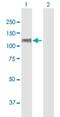 Centrobin, Centriole Duplication And Spindle Assembly Protein antibody, H00116840-B01P, Novus Biologicals, Western Blot image 