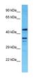 Transmembrane Protein 116 antibody, orb327122, Biorbyt, Western Blot image 